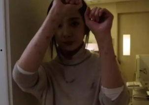 浑身是伤的图片